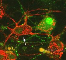 Нейроны интеральной нервной системы