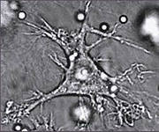 Дендритная клетка - клетка Лангерганса